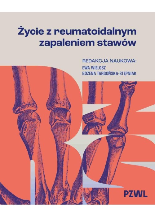 Życie z reumatoidalnym zapaleniem stawów