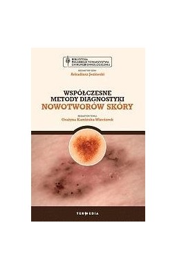 Współczesne metody diagnostyki nowotworów skóry
