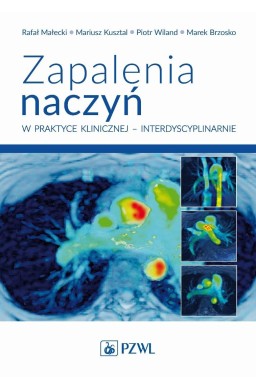 Zapalenia naczyń w praktyce klinicznej...
