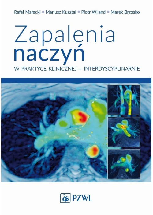 Zapalenia naczyń w praktyce klinicznej...